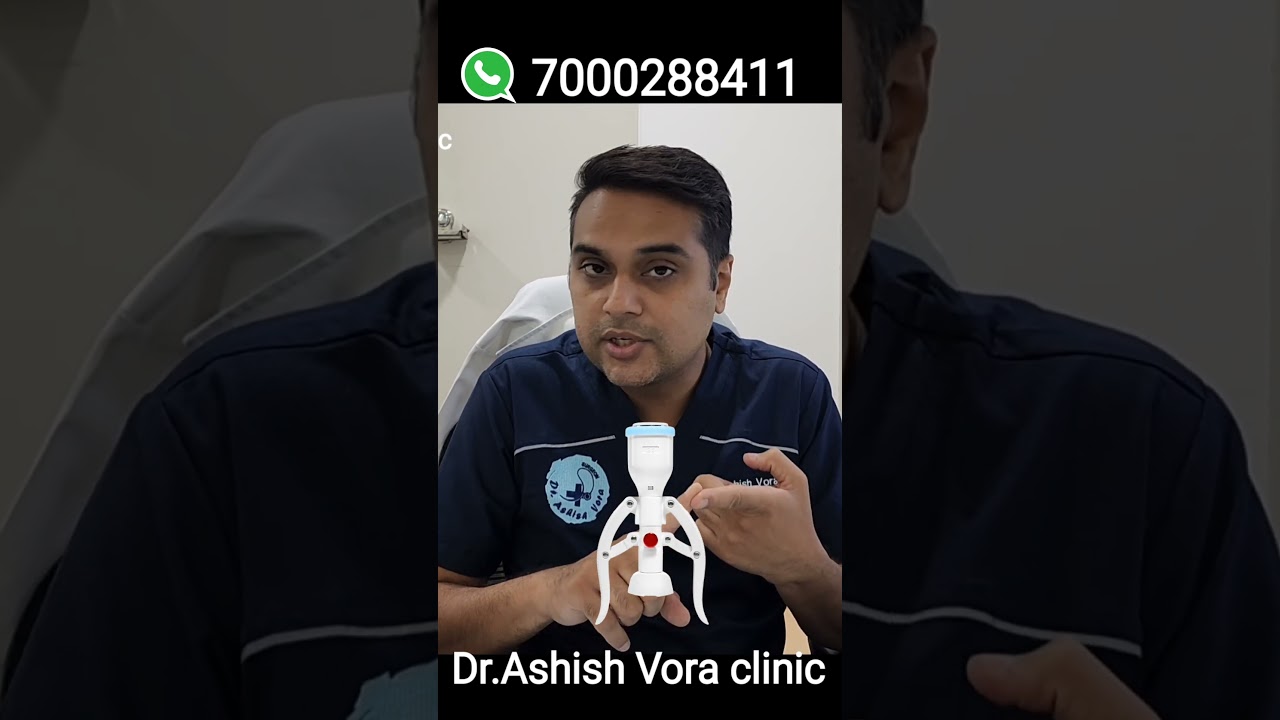 Best ZSR Circumcision Doctor in india | 