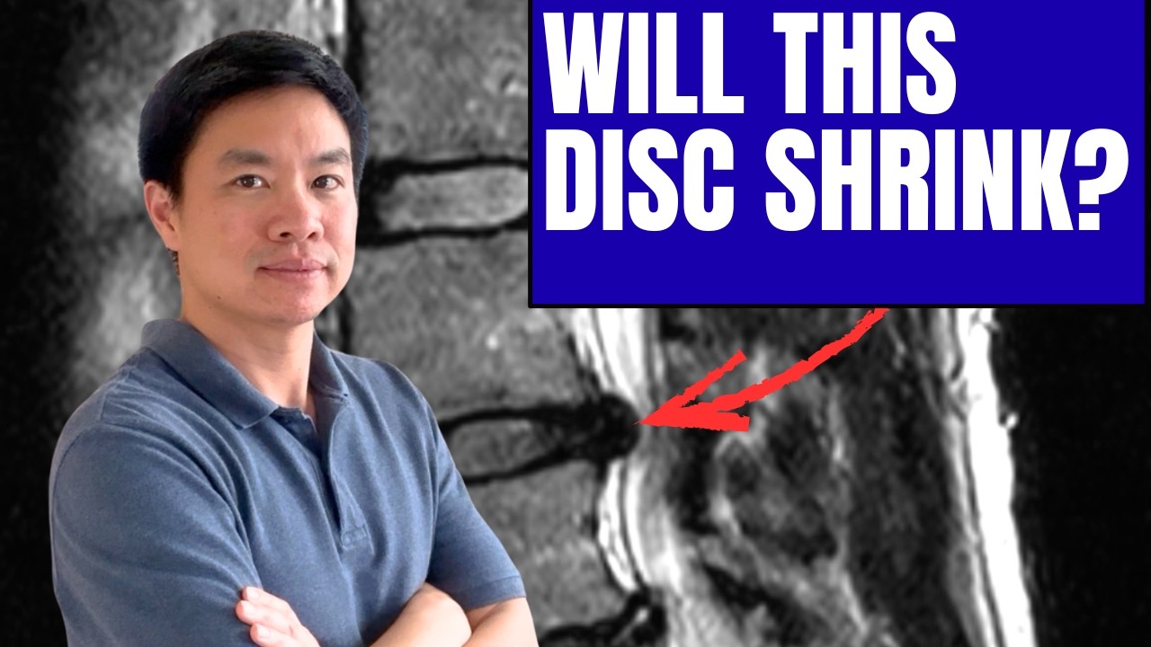 Why Some Disc Bulges Shrink (And Others Don’t)