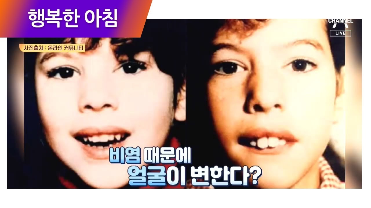 환절기 비염 환자 급증! 가을에 특히 코가 막히는 이유는? (ㅠㅠ) | 행복한 아침 168회