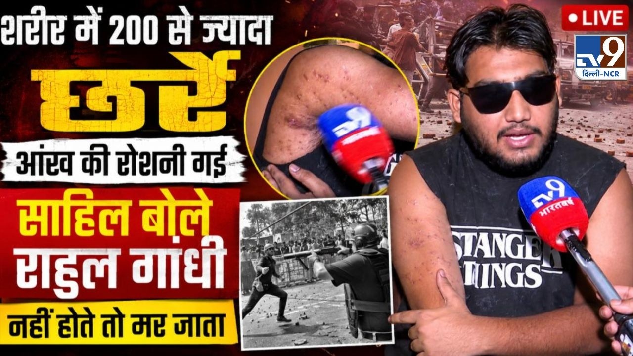 LIVE: पैलेट गन के छर्रों से घायल साहिल लोचव ने बताया, Rahul Gandhi नहीं होते तो..! | CJP Protest