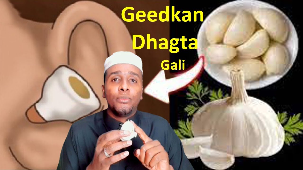Geedkan Dhagta saar waxa Dhacaya Haddii ad Toon ku Dhejiso mudo saacada mucjiso Rabbaani Dadku Aqoon