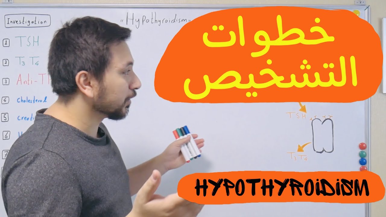التحاليل وخطوات تشخيص نقص هرمونات الدرقية Hypothyroidism Investigations