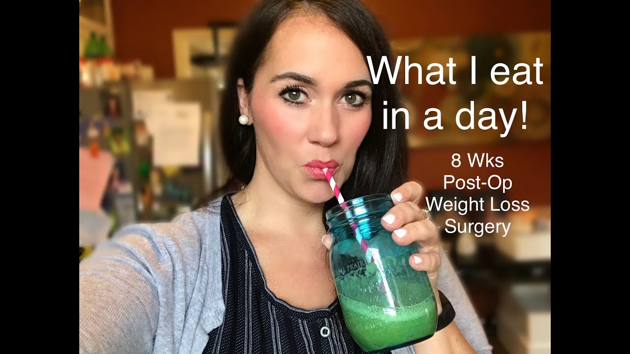 What I Eat in a Day! | 8 Wks Post-Op | RNY Gastric Bypass | Weight Loss Surgery