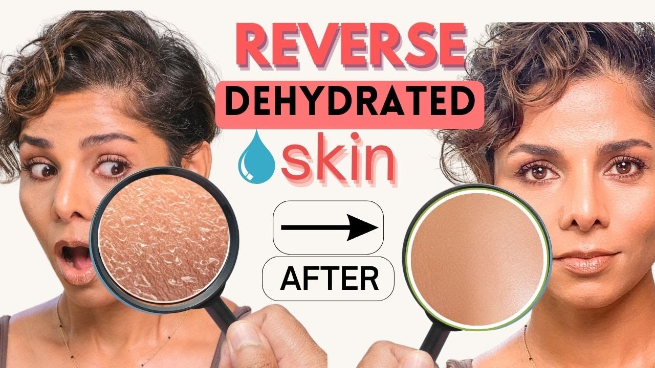How to Keep your FACE SKIN HYDRATED | 10 Ways You Can Boost Moisture in DEHYDRATED SKIN