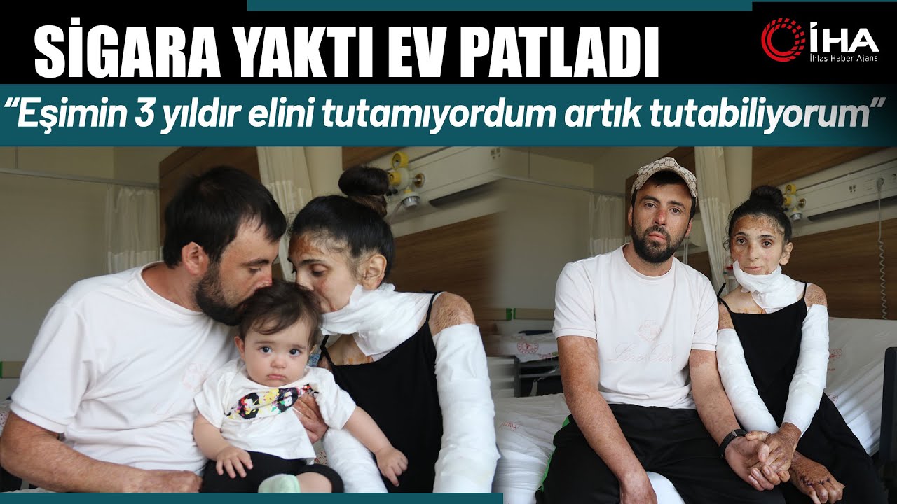 Azerbaycanlı Çiftin Patlamada Kapanan Elleri Eskişehir'deki Tedaviyle Kavuştu