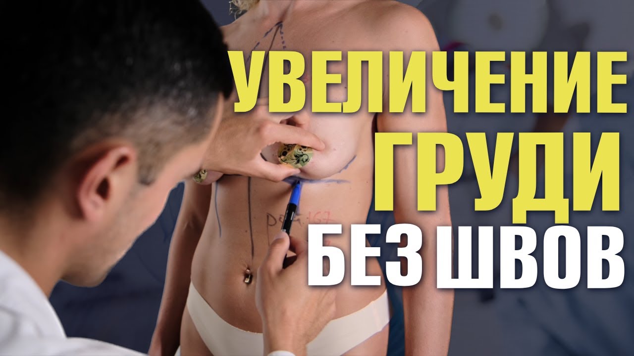 Выполняю бесшовное увеличение груди по методике 