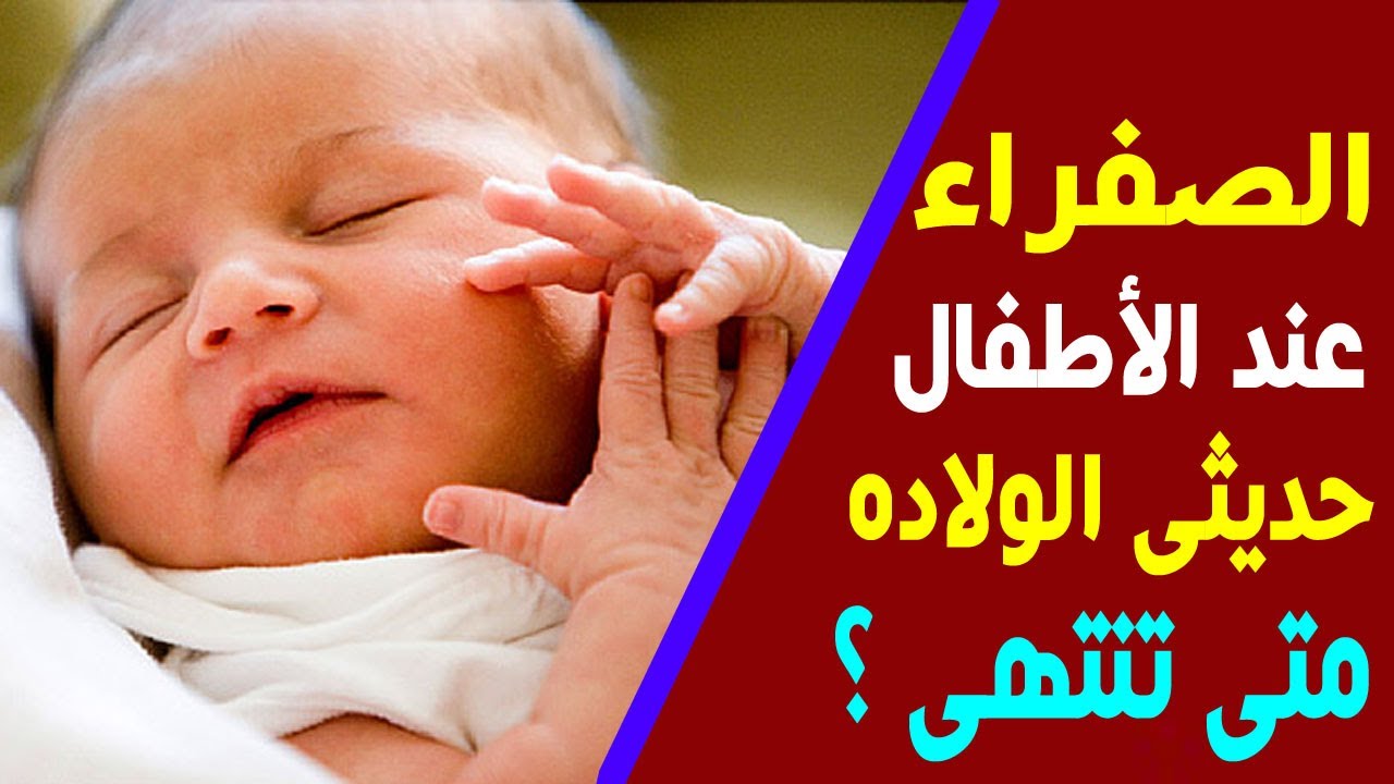 متى تنتهى الصفراء عند الأطفال حديثى الولاده ؟ وهل هى خطيره على المولود الجديد ؟