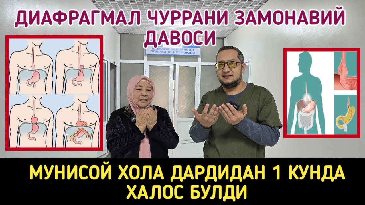 ДИАФРАГМАЛ ЧУРРАНИ ЗАМОНАВИЙ ДАВОСИ