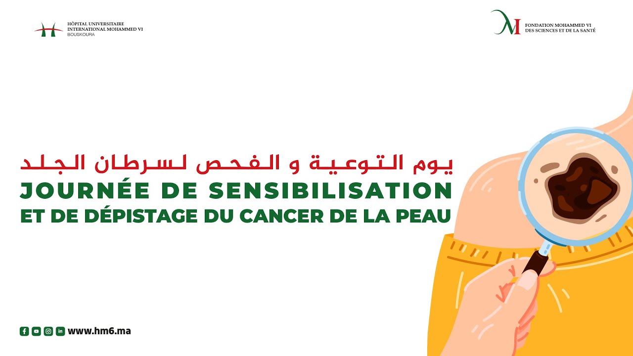 يوم التوعية و الفحص لسرطان الجلد