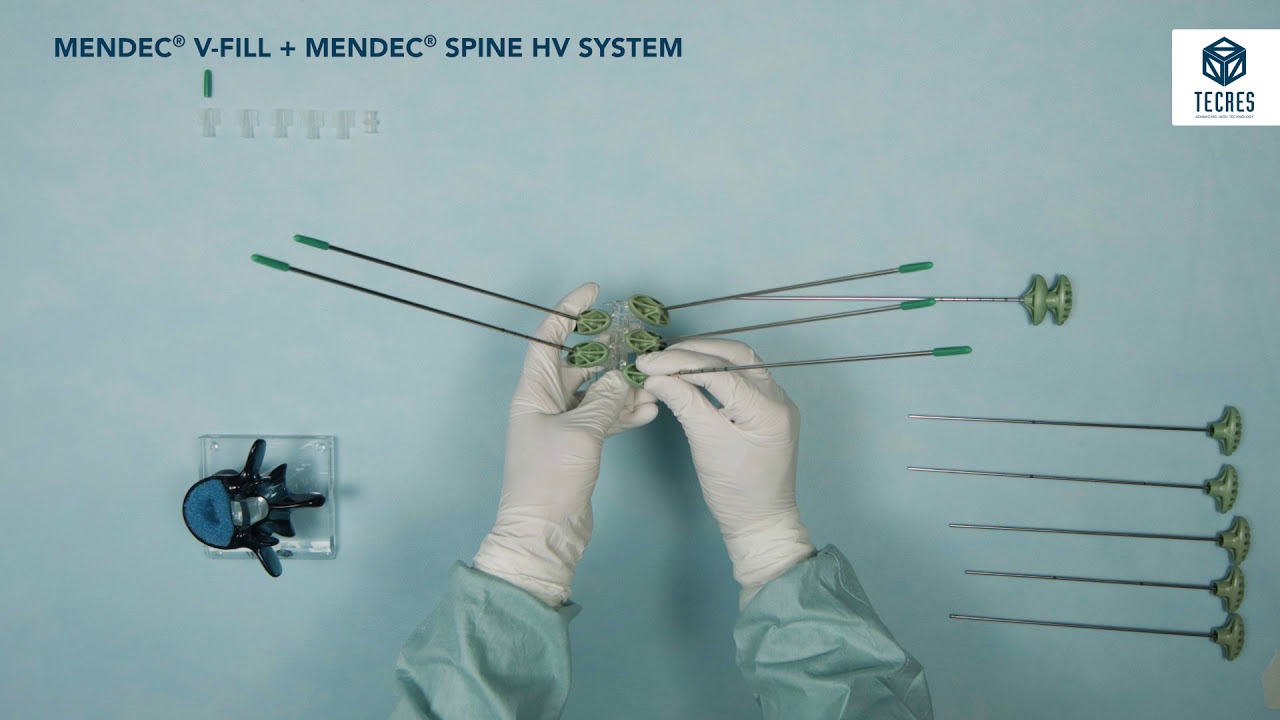 Mendec® V-Fill + Mendec® Spine HV System