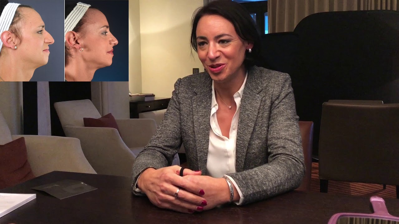 Facial Feminization Surgery Review -  Jenny, Dr Bart van de Ven reviews