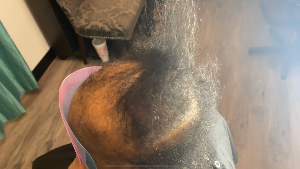 Alopecia weave alternative | Scarred alopecia weave