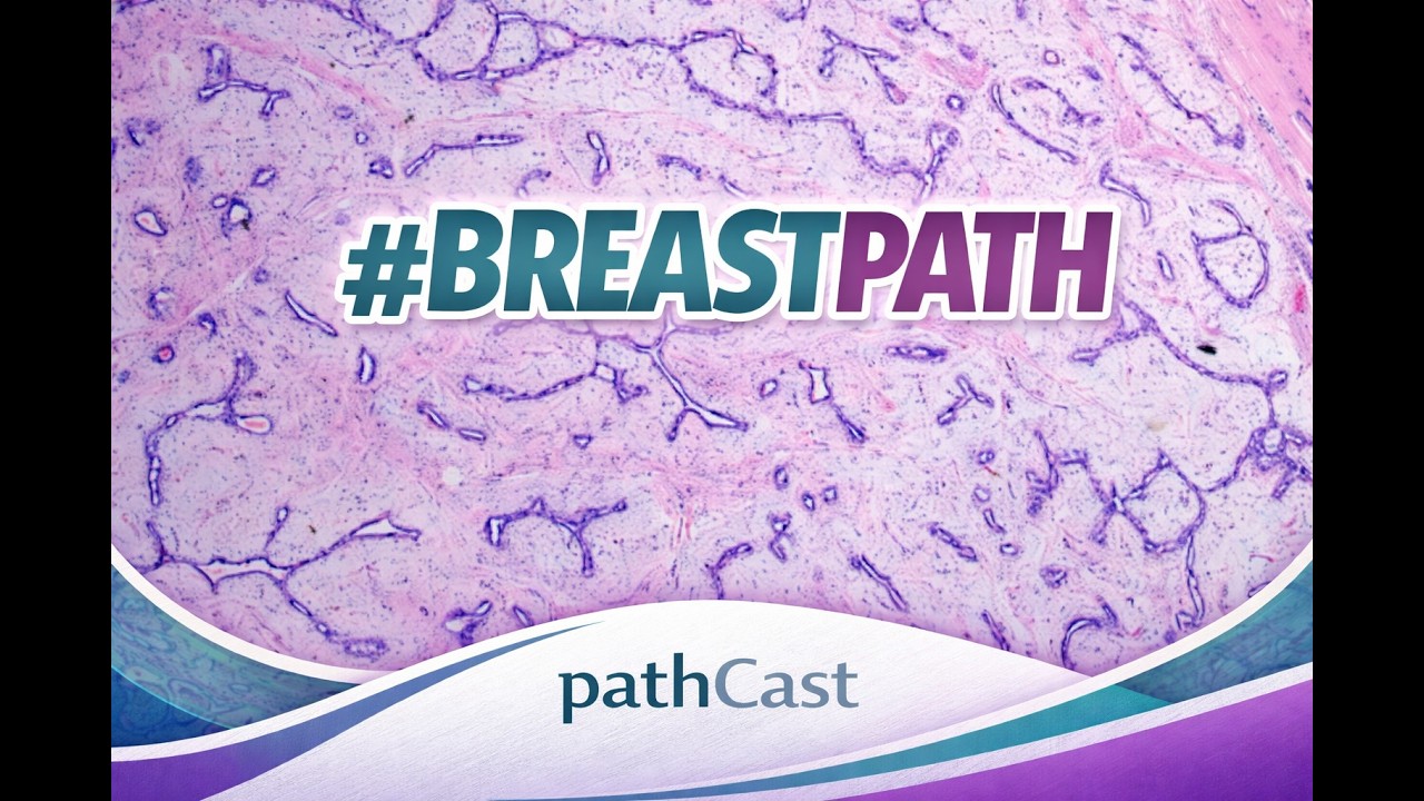 Breast spindle cell lesions - Dr. Cimino-Mathews (Hopkins) #BREASTPATH