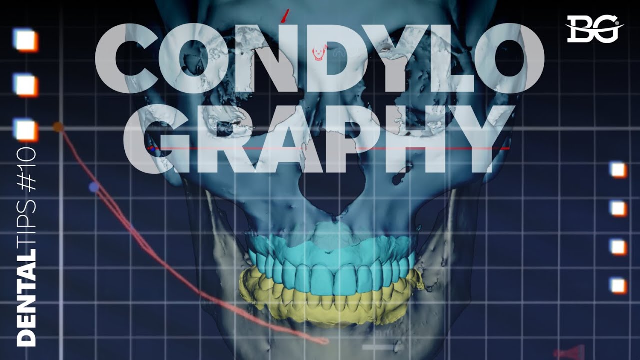Condylography and joint click