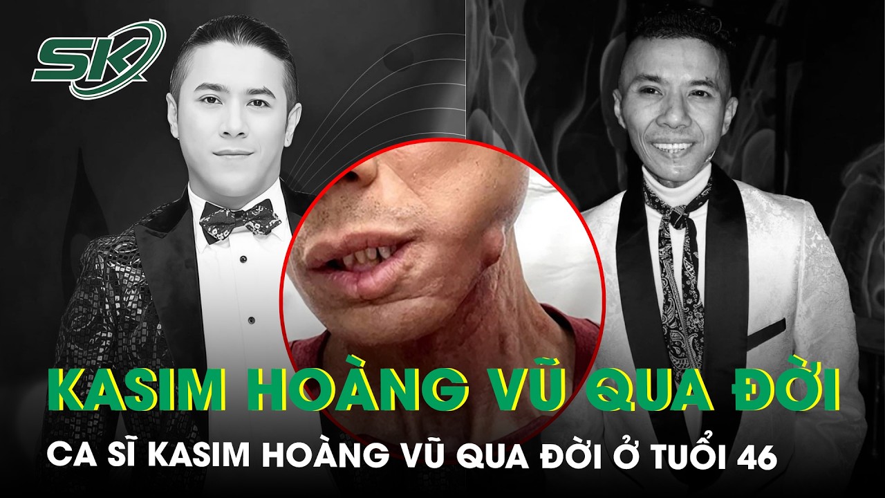 Ca sĩ Kasim Hoàng Vũ qua đời ở tuổi 46 sau thời gian chống chọi bạo bệnh, hình ảnh cuối đầy xúc động