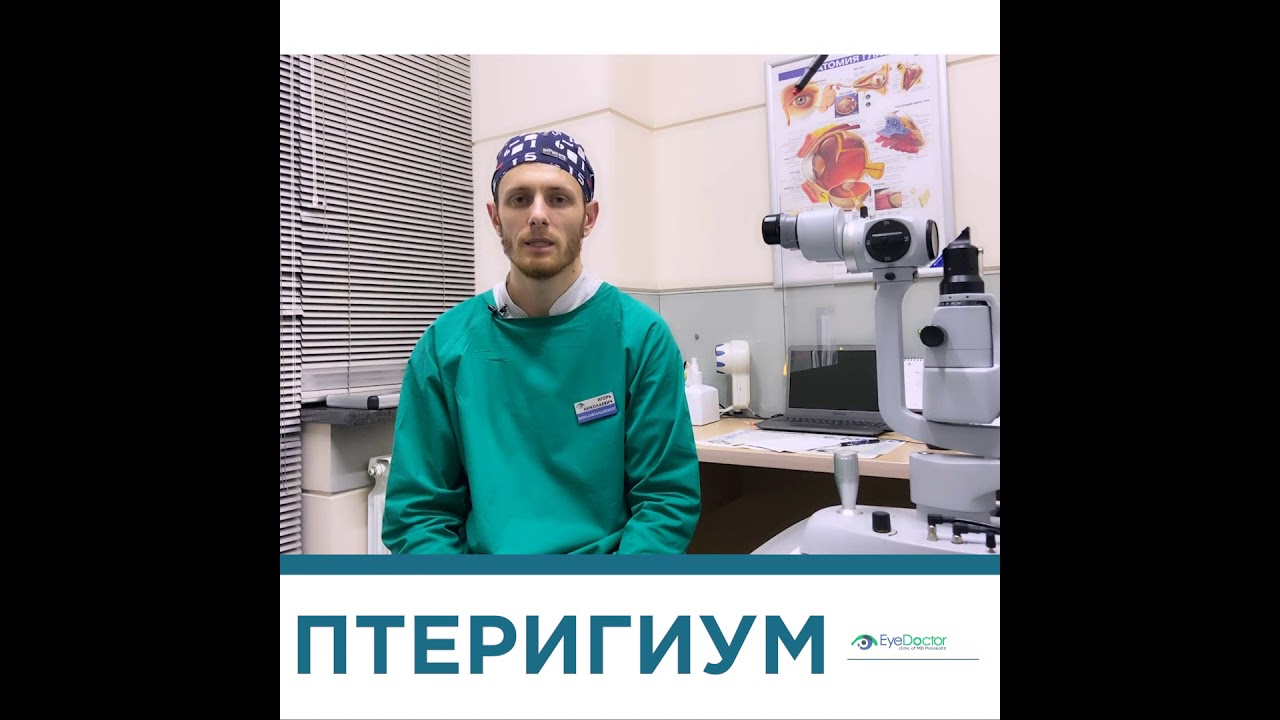 птеригиум