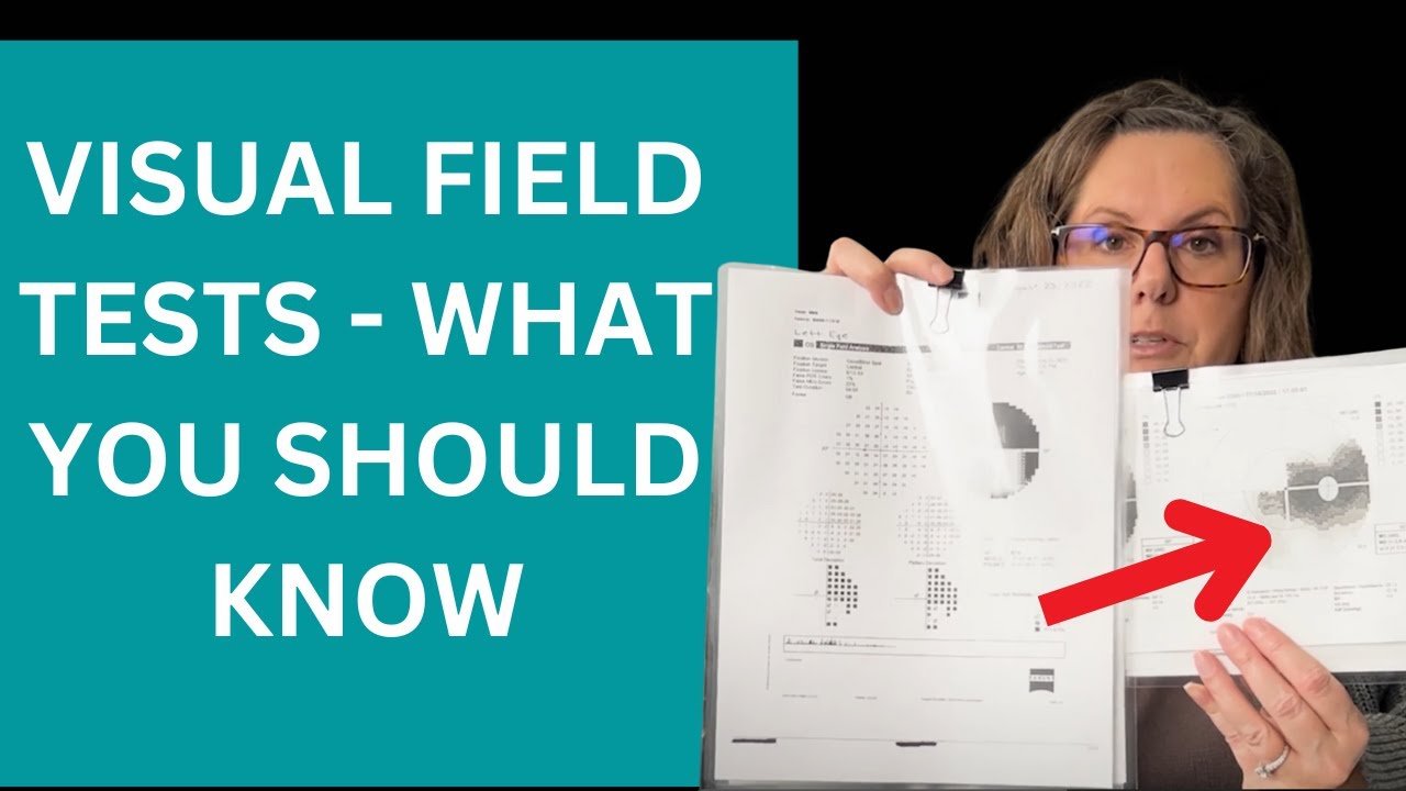Visual Field Tests | What You Should Know