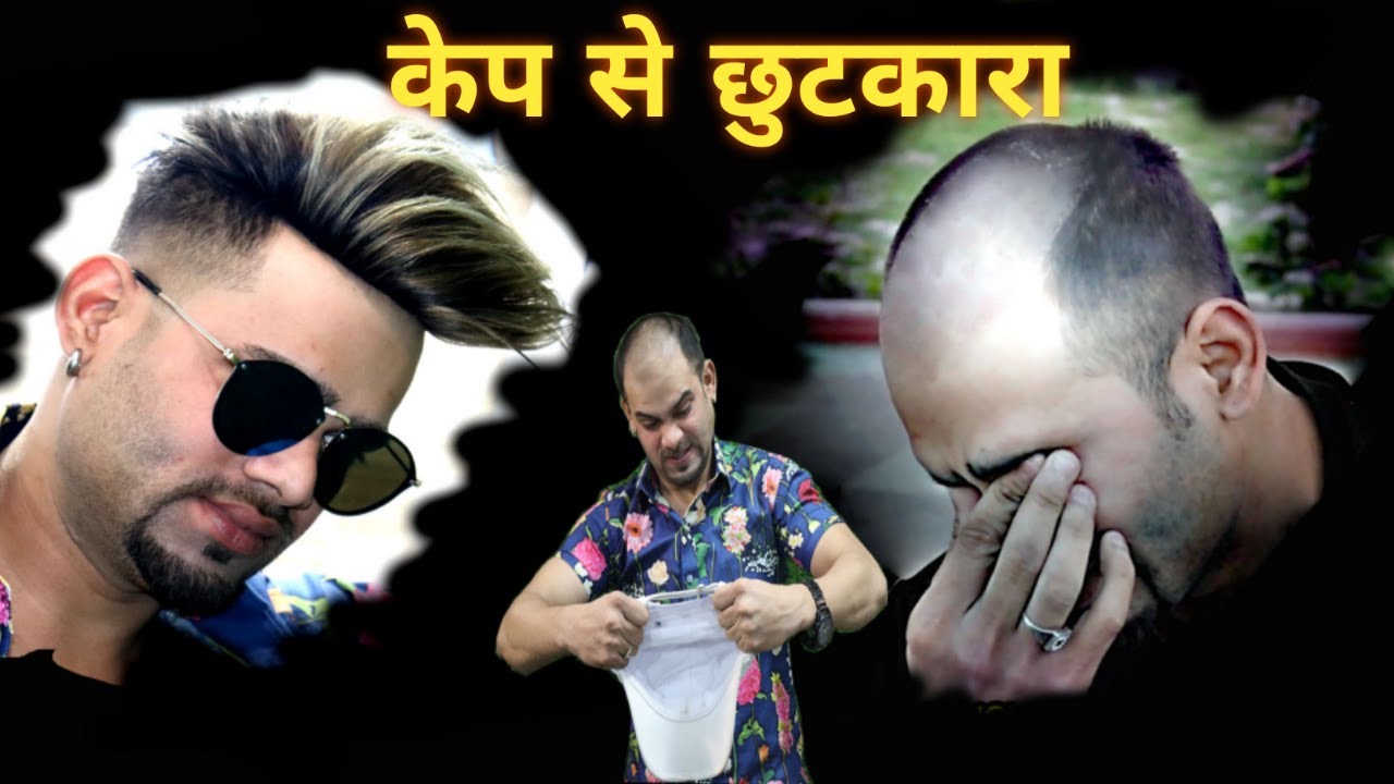 HAIR PATCH JOURNEY SHORT MOVIE CONTACT-(9711944387)||PRINCE KING HAIR!
