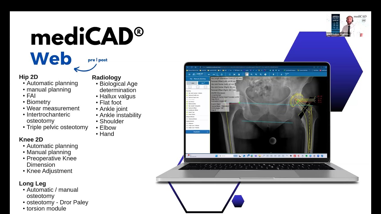 WEBINAR: MedDream Viewer integration with mediCAD orthopedic solutions