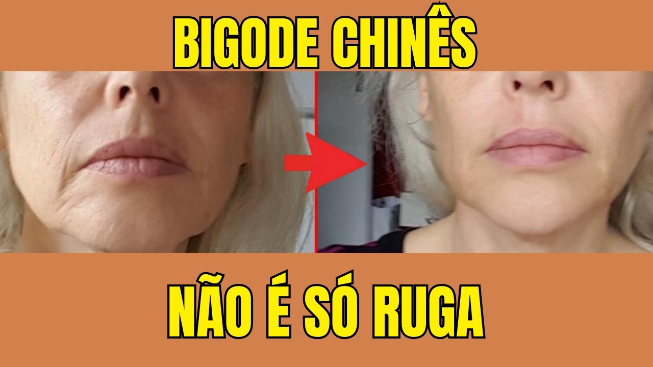 Bigode Chinês: O Que Ninguém Te Contou (E Como Amenizar Isso)