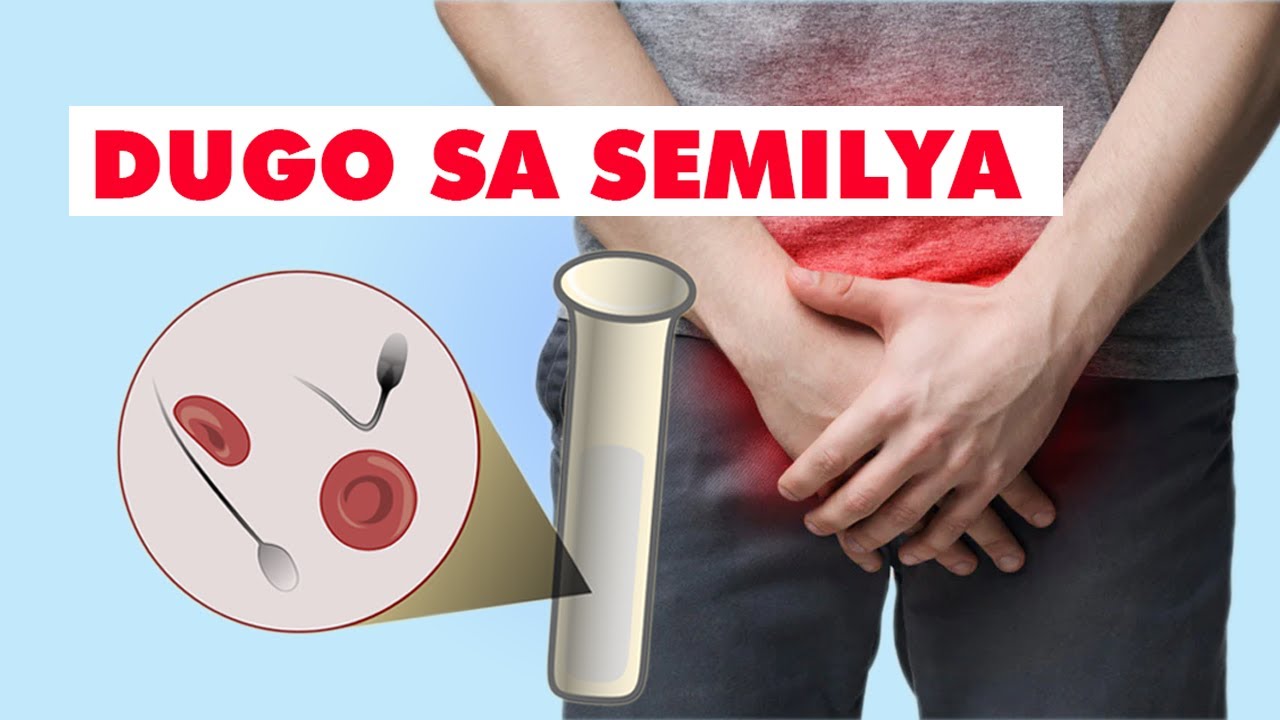 [Q & A] DUGO SA SEMILYA (HEMATOSPERMIA), LUMALAKING ITLOG, SPIRULINA ATBP.