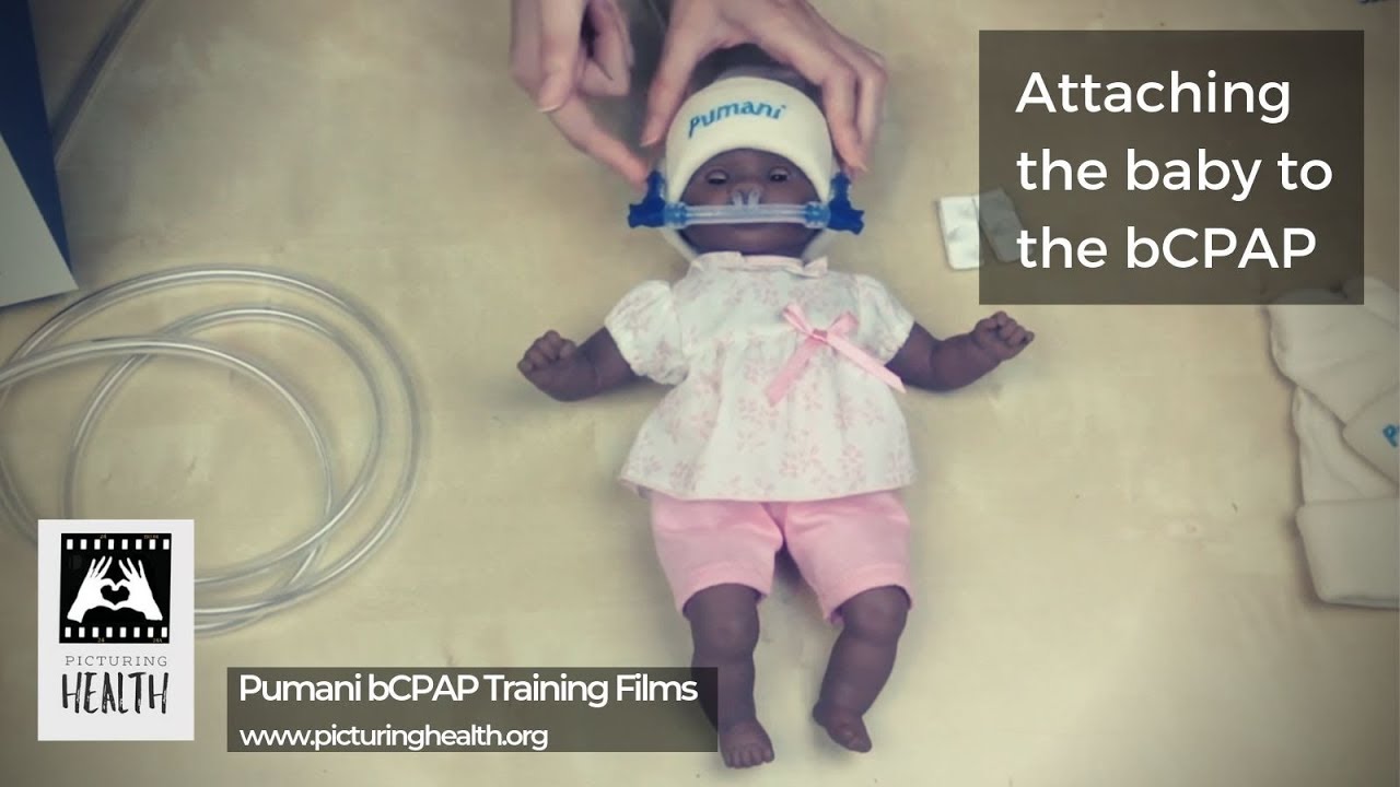 Attaching the baby to the CPAP machine (Pumani bCPAP training films: Section 6 of 13).