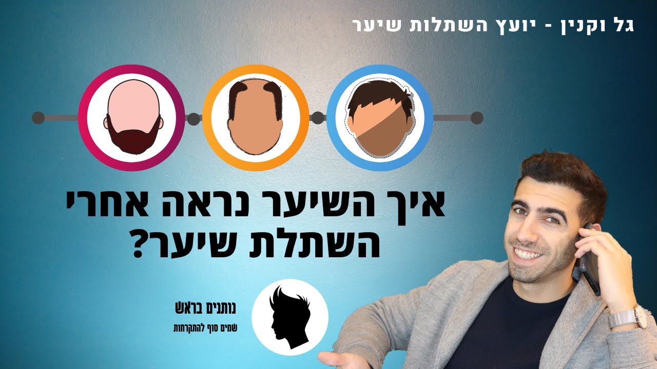 איך השיער נראה אחרי השתלת שיער? -  נותנים בראש  | גל וקנין