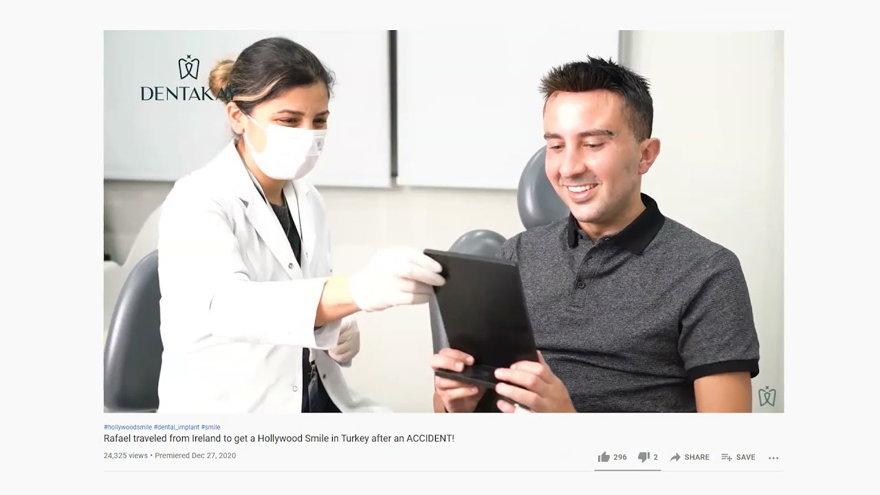 FULL HOLLYWOOD SMILE PROCEDURE | BEFORE & AFTERS AND WHOLE EXPERIENCE