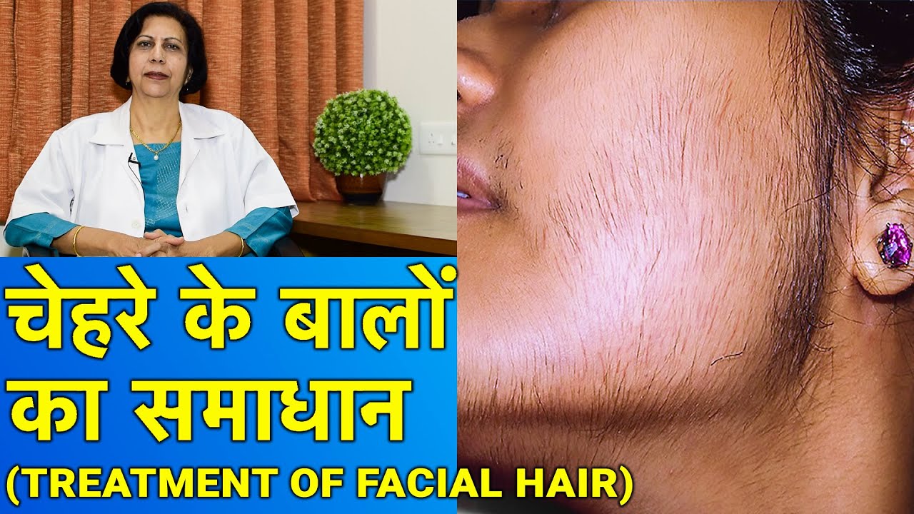 चेहरे के बालों का समाधान || Facial Hair Treatment (In HINDI)