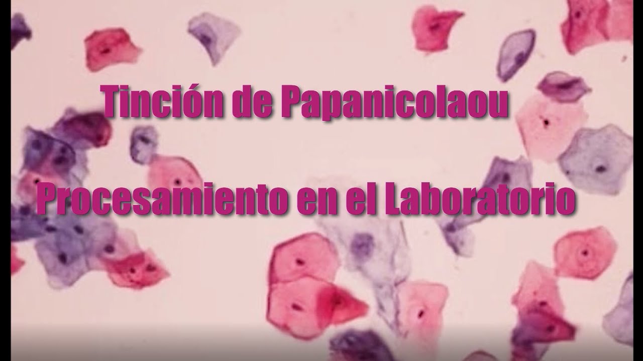 Tinción de Papanicolaou: Procedimiento en el Laboratorio🔬🔬. No se olviden de suscribirse 👍👍🤝🤝‼️‼️