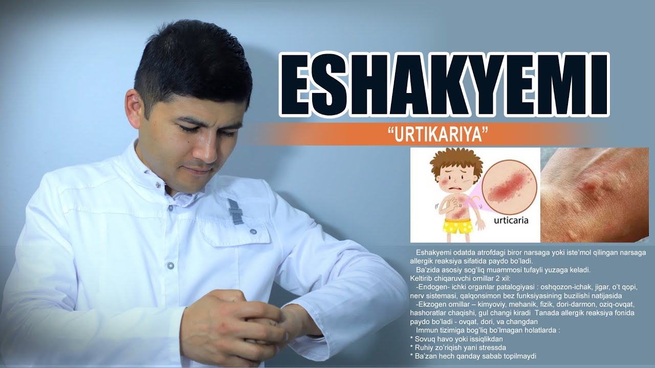 Eshakyemi(Torvoq, qavarchiq, Krapivnitsa) nima ? Kelib chiqish sabablar,ko'rinishi va davosi
