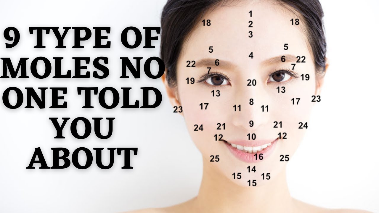 9 types of mole on your face| Facial Mole and body mole reading| Chinese Astrology