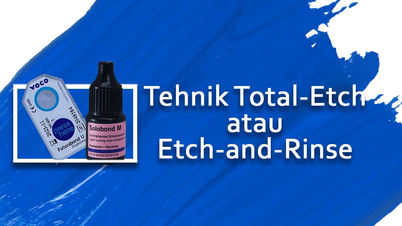 Teknik Total-Etch atau Etch-and-Rinse | Sistem Adhesif Penambalan Resin Komposit Bonding VOCO