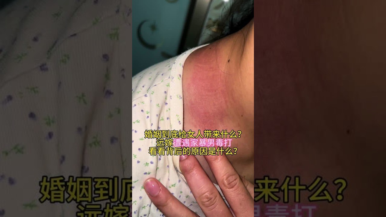 婚姻到底给女人带来什么？远嫁遭遇家暴男毒打  看看背后的原因是什么？为了孩子，我终于敢直面内心的答案一次次选择原谅，一回回递出机会 支撑我走下去的从来不是对这个家的期待  而是怀里的孩子 我总劝自己