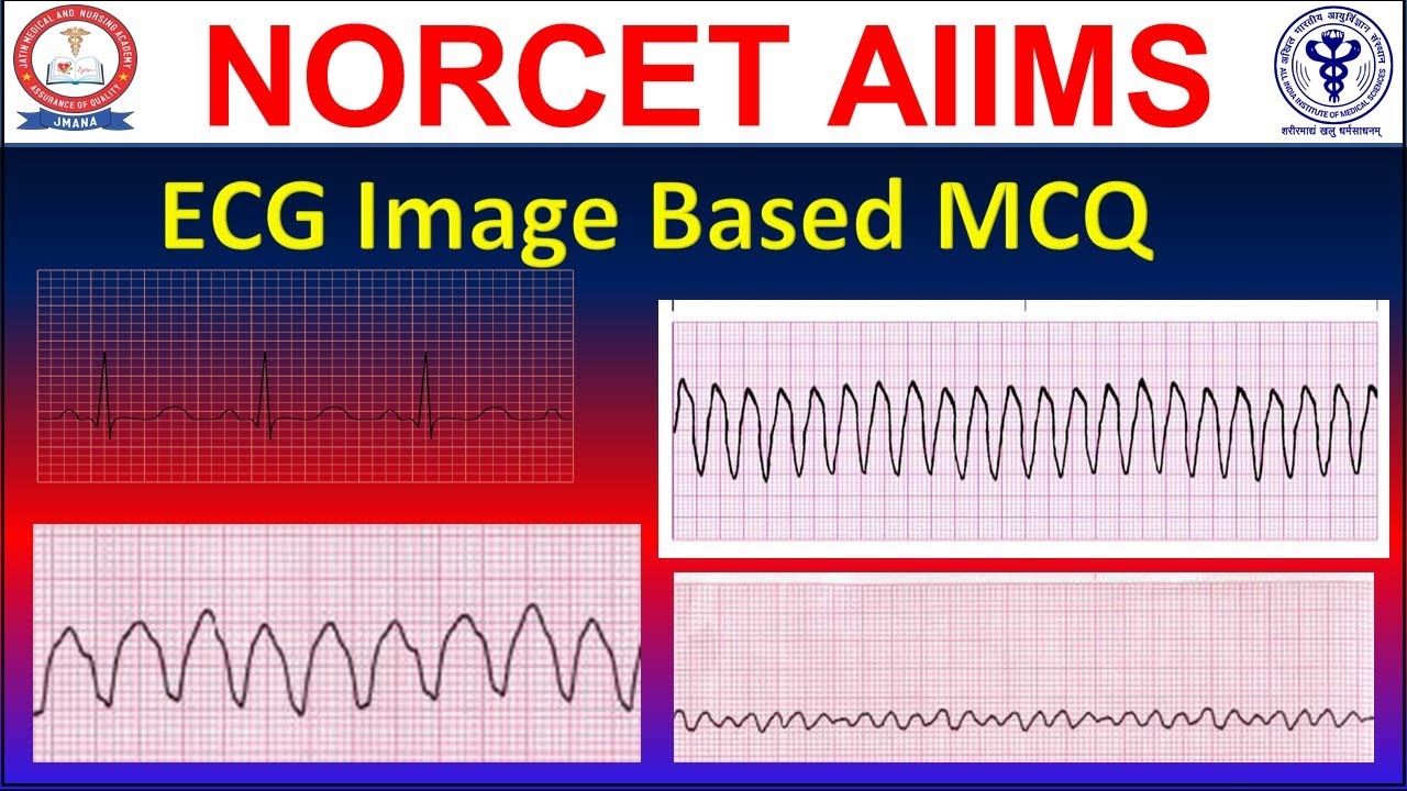 AIIMS NORCET Exam || ECG Image Based MCQ Discussion || Electrocardiography Image Questions | #NORCET