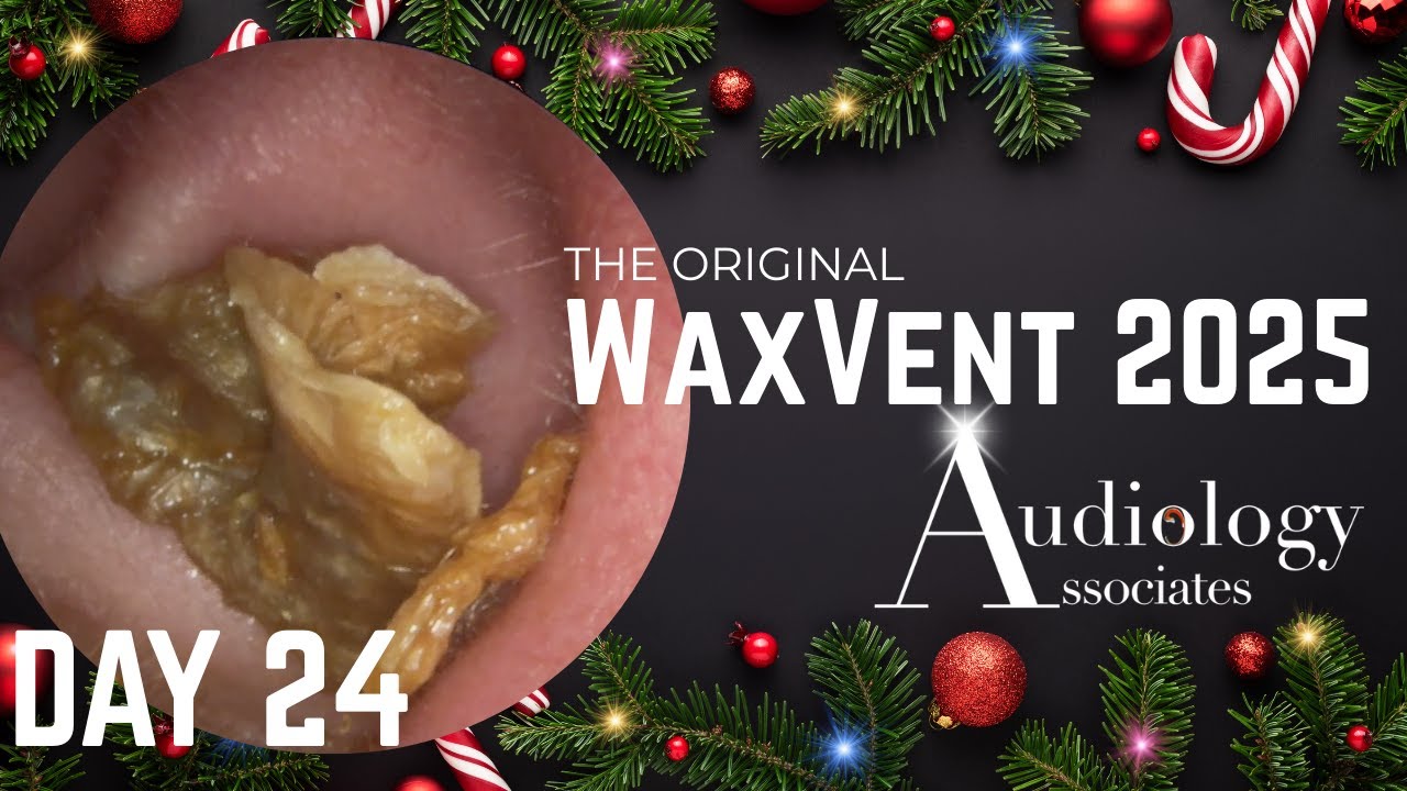 Massive Keratosis Plug + Deep Skin Layers! - Waxvent Day 24
