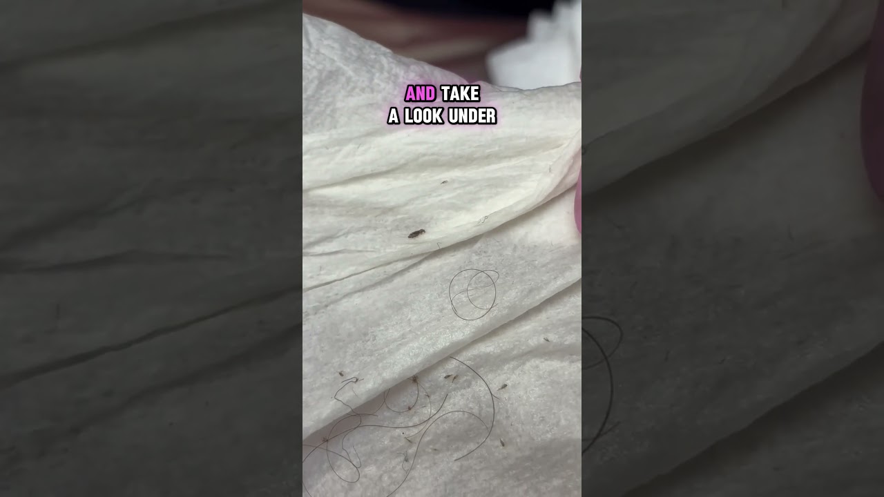 what does REAL head lice look like? #fyp  #youtubeshorts #hairtok #hair #headlice #lice #bug