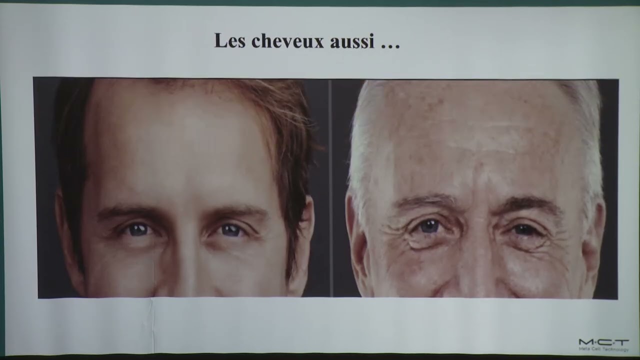 Exosomes autologues : la médecine régénérative au cœur de l'esthétique médicale - Dr Yosra Labidi