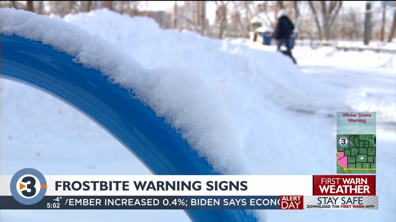 How to prevent and treat frostbite amid extreme cold