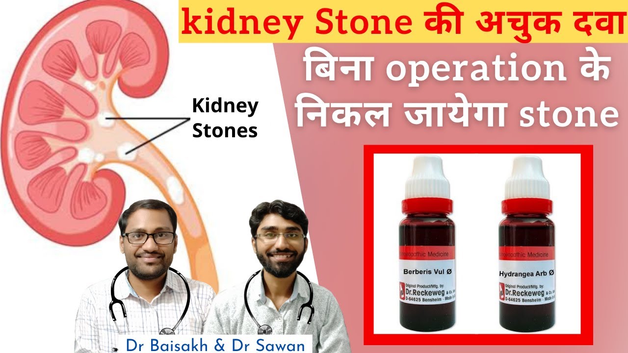 Homeopathic medicine for kidney stone- पथरी का होम्योपैथिक इलाज // kidney stone की रामबाण दवा