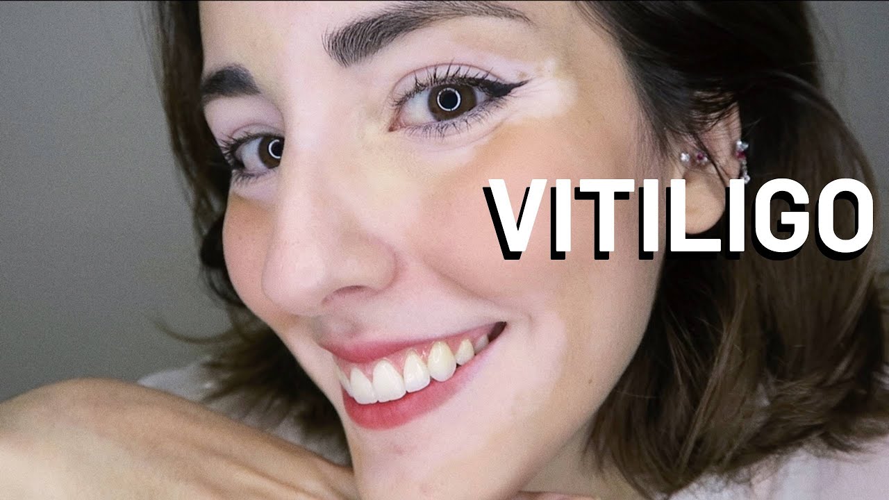 Porque eu decidi parar com os tratamentos?