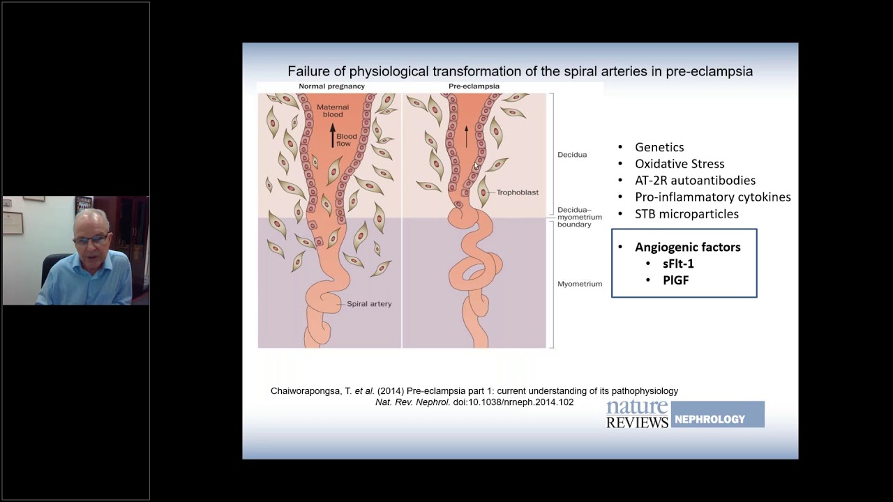 ANSC Hypertension Update 13 October, 2020