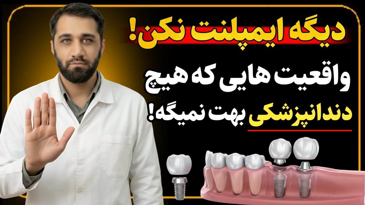 ایمپلنت نکن ! واقعیت هایی که اکثر دندانپزشک ها نمیگن !