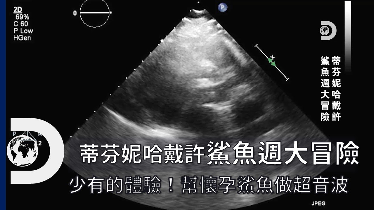 在海中幫母鯊做產前檢查？相當稀有的鯊魚小寶寶超音波！《2021鯊魚週：蒂芬妮哈戴許鯊魚週大冒險》