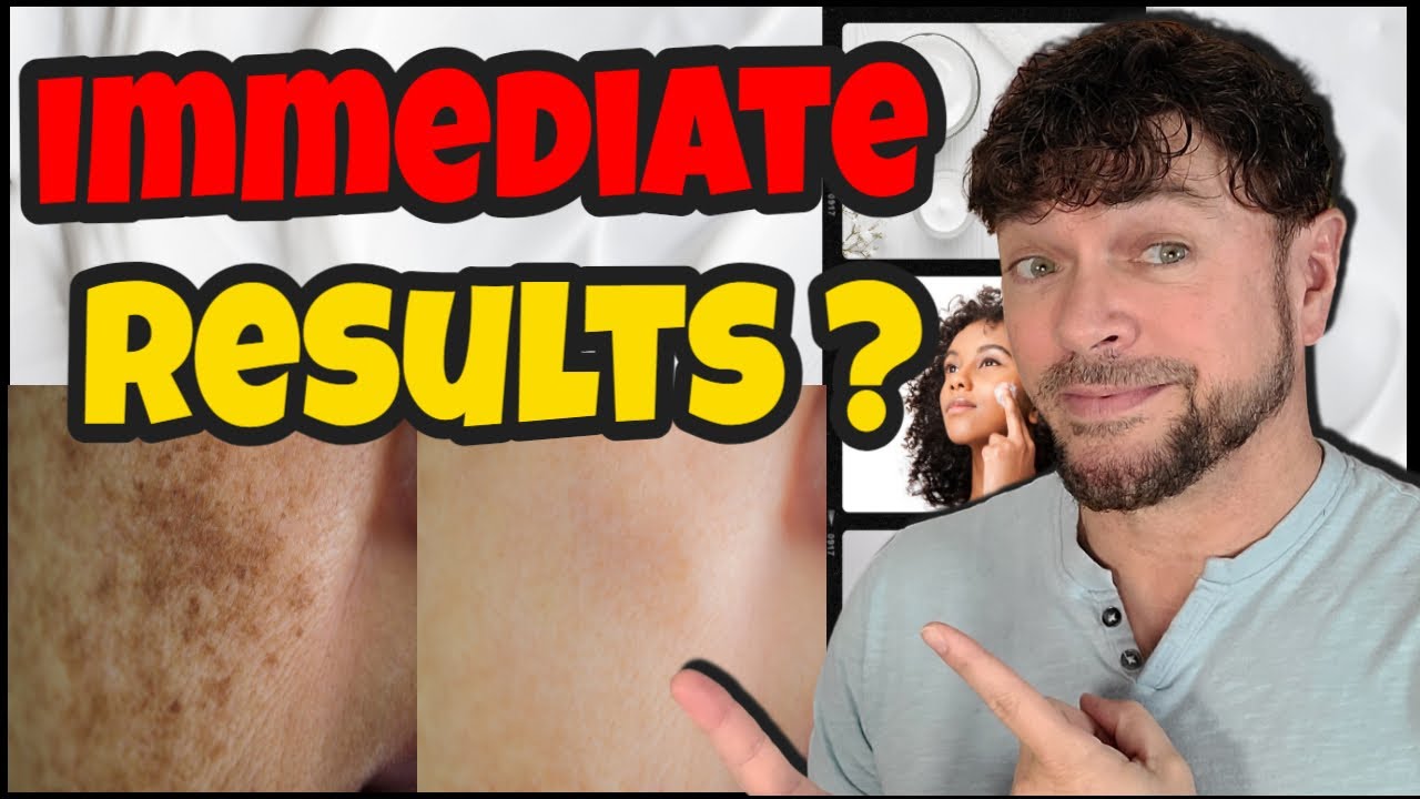 Are Immediate Results For Hyperpigmentation Possible | Chris Gibson