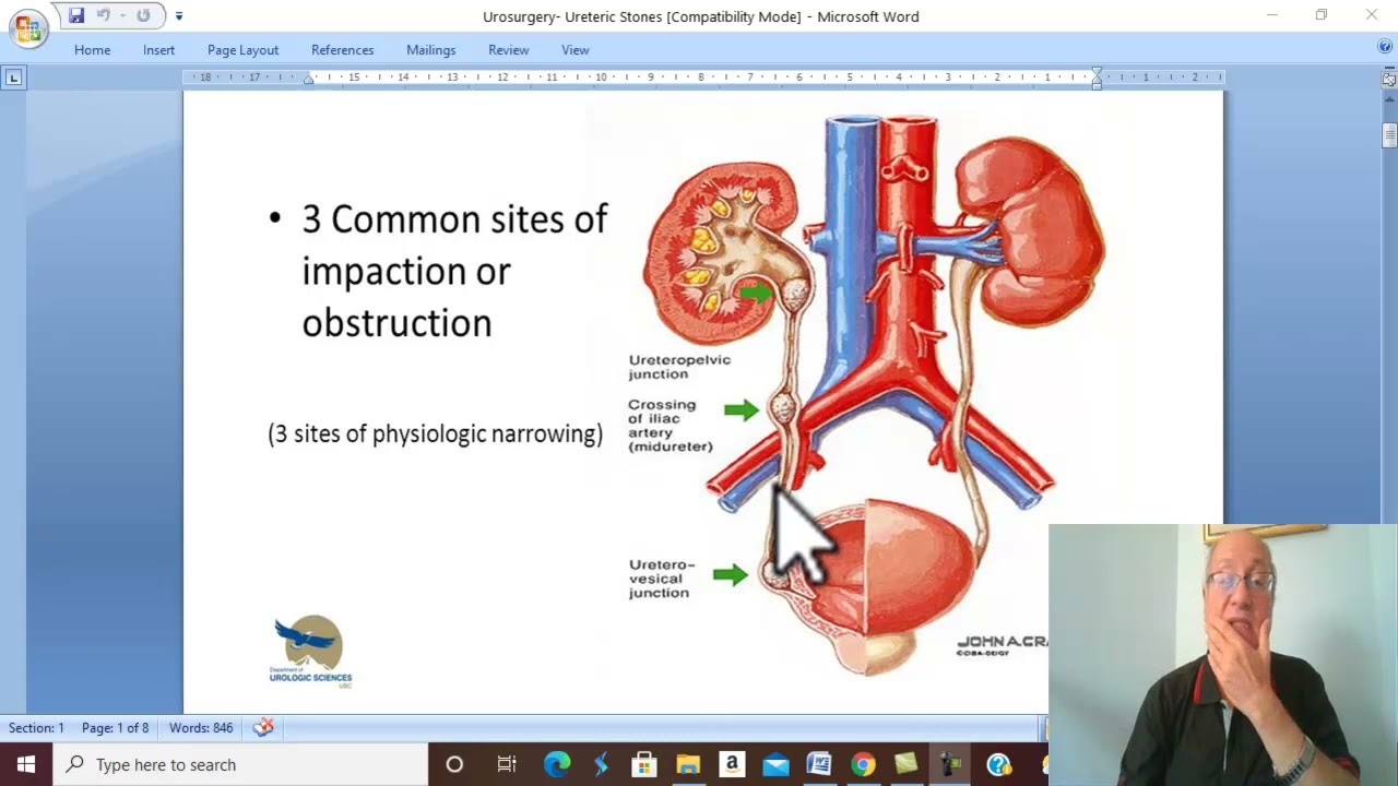 Urosurgery in Arabic 8 (Ureteric Stones , part 1 ) , by Dr. Wahdan