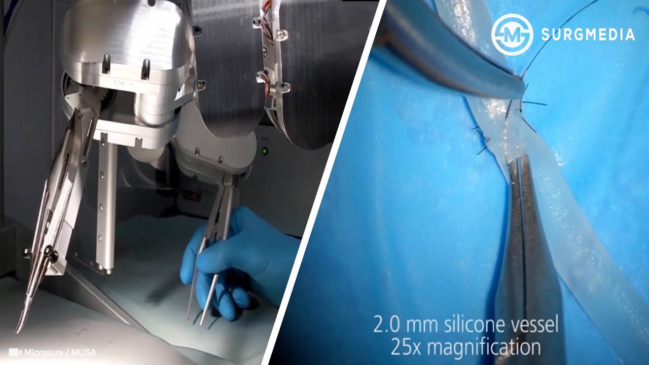 World’s First Clinically Available Microsurgical Robotic System: Super-Microsurgery with Robot Hands