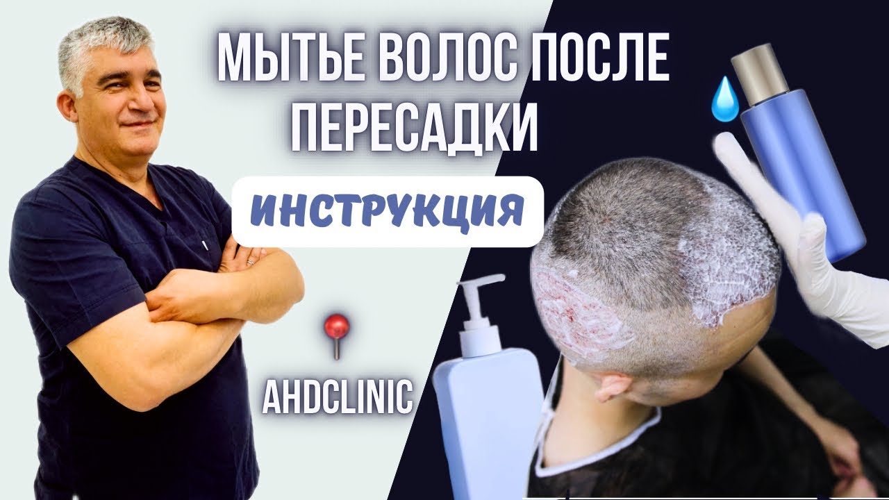 ПЕРЕСАДКА ВОЛОС.МЫТЬЕ ГОЛОВЫ.ПОЛЕЗНАЯ ИНСТРУКЦИЯ