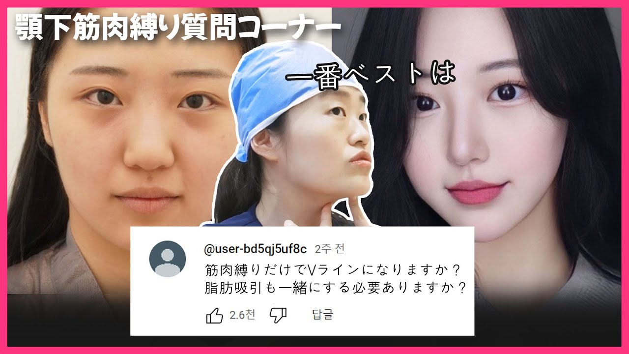 [ペリカン手術🦜]顎下脂肪吸引と顎下筋肉縛りについて聞きたいこと全部聞いてみた❗