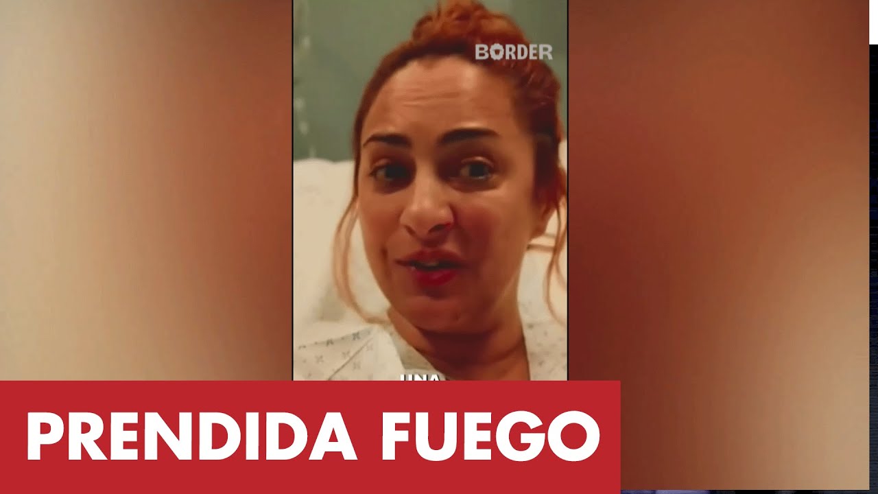 Mar&iacute;a Julia Oliv&aacute;n relat&oacute; el impactante accidente que la dej&oacute; internada: &ldquo;Me prend&iacute; fuego&rdquo;